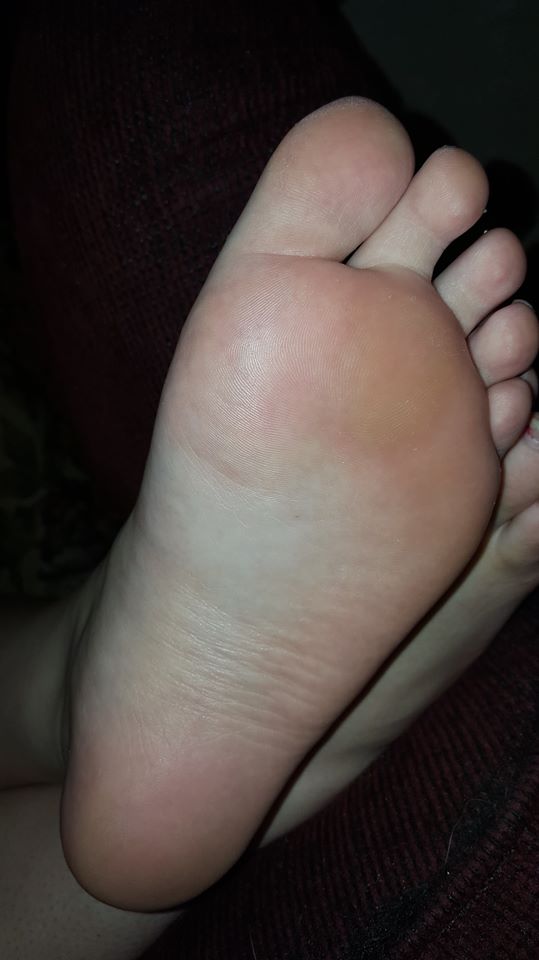Foot Picture
