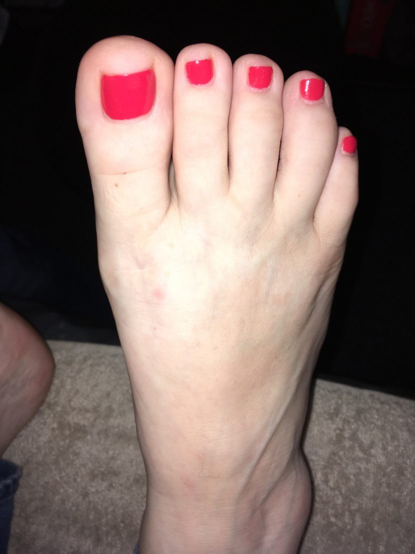 Foot picture