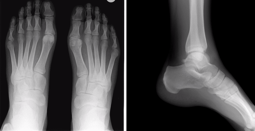 medical reflexology pic