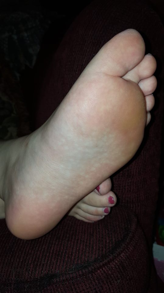 Foot picture