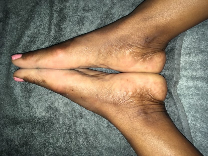 foot picture