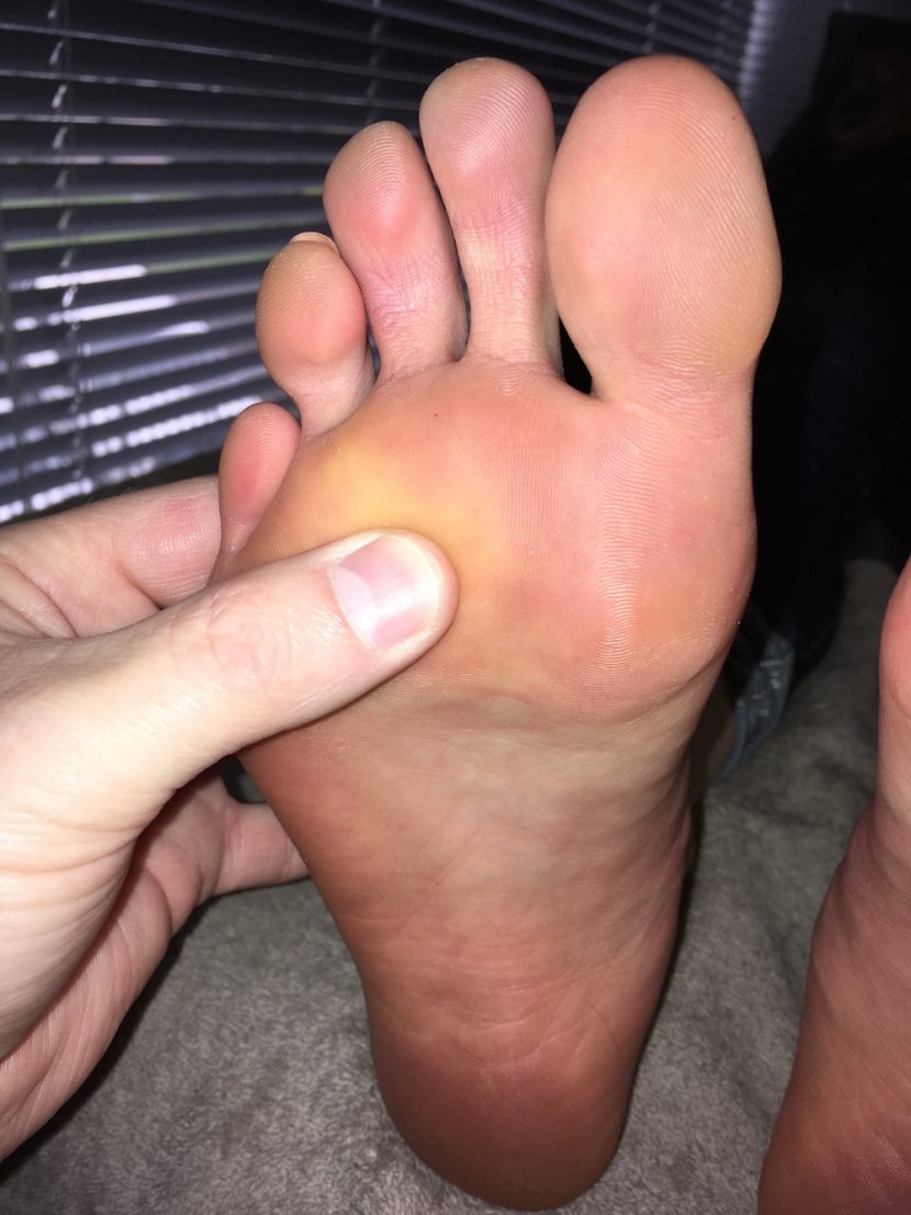 Foot picture