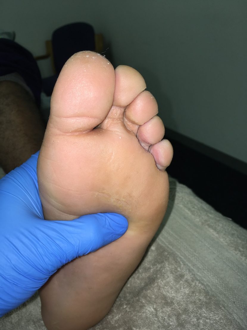 Foot picture