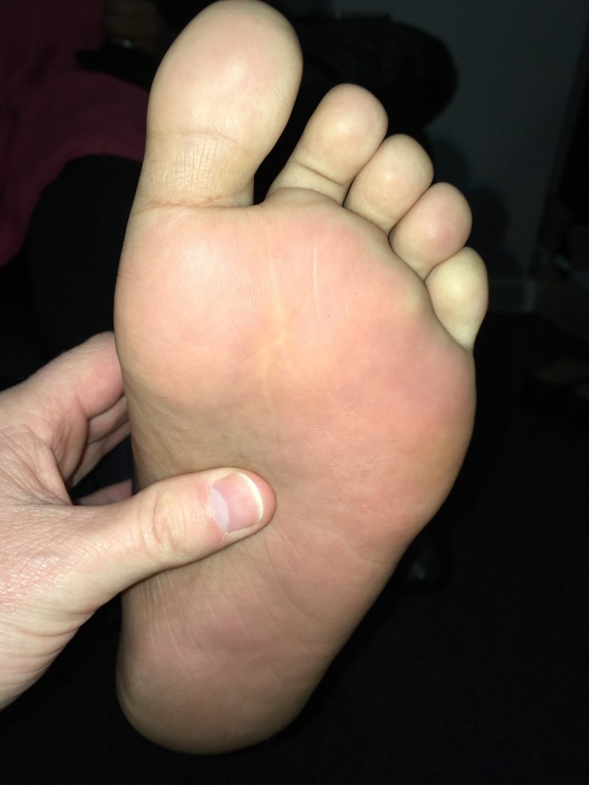 foot picture