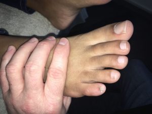 foot picture