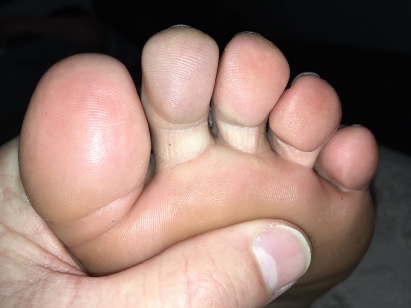 foot picture