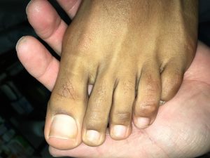foot picture