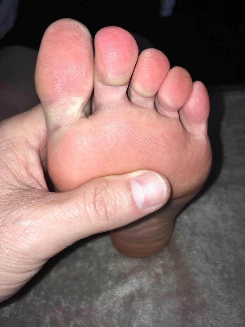 foot picture