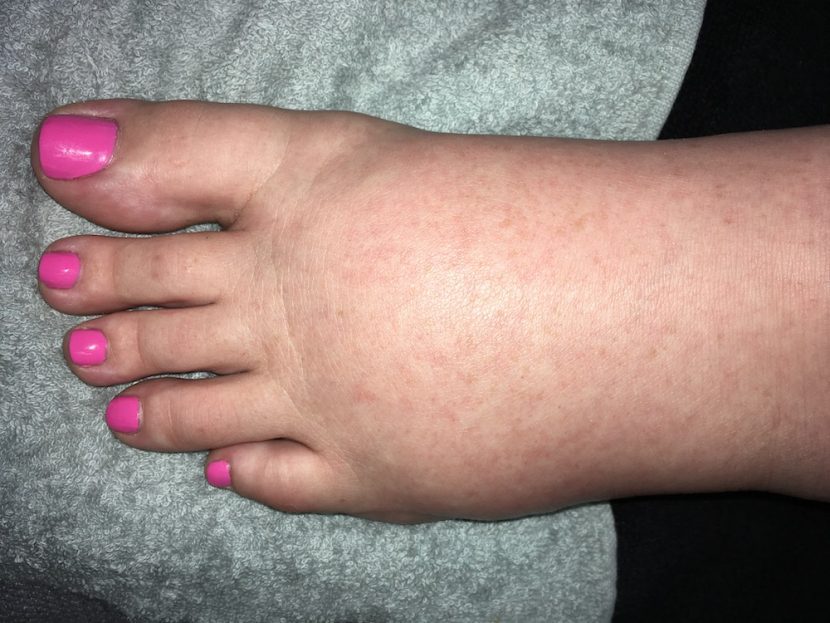 foot picture