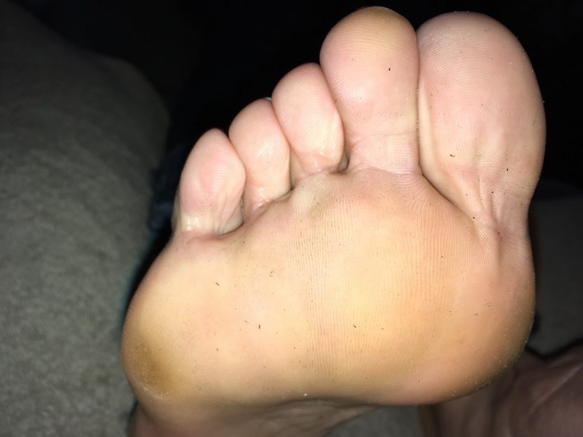 foot picture