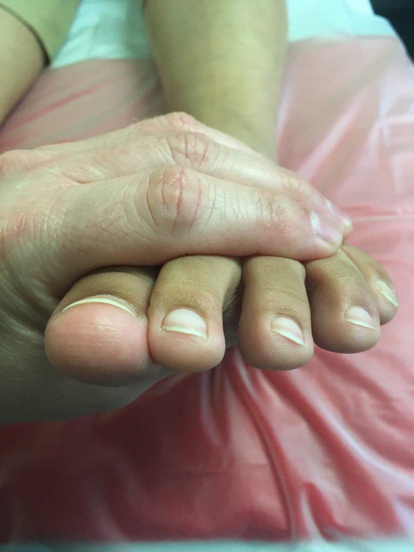 foot picture