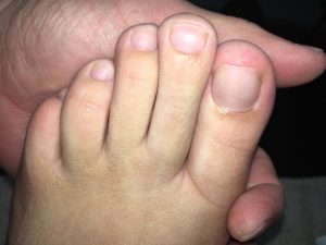 foot picture