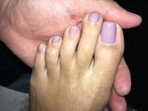 foot picture