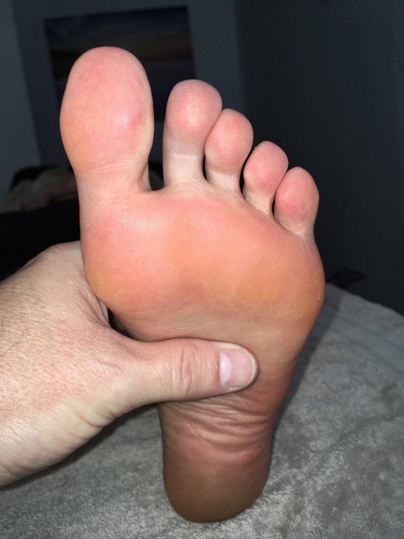 foot picture