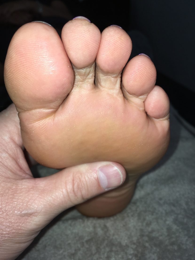 foot picture