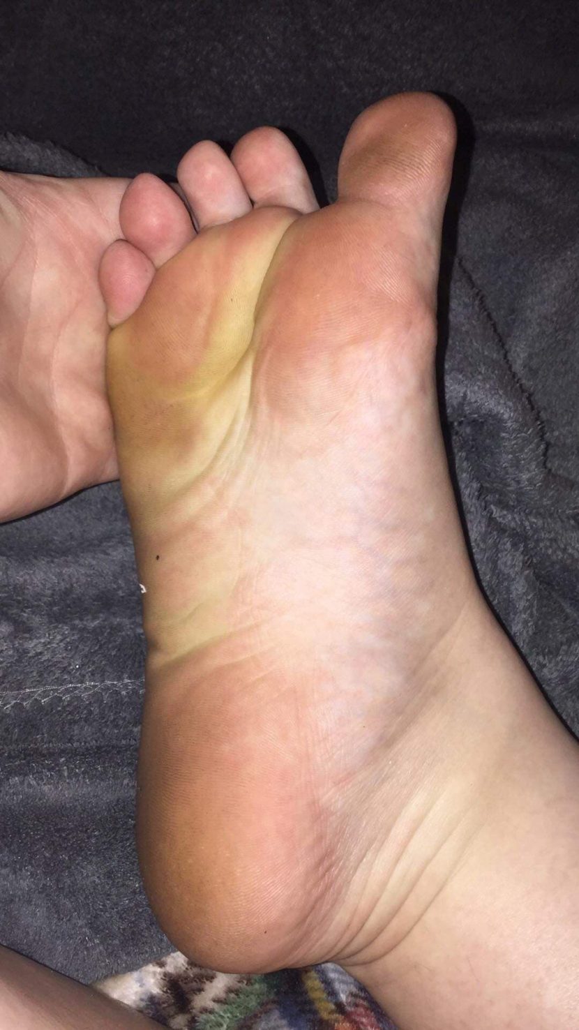 foot picture