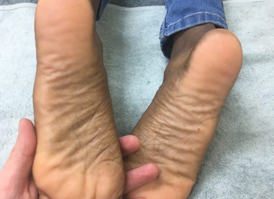 Foot Picture